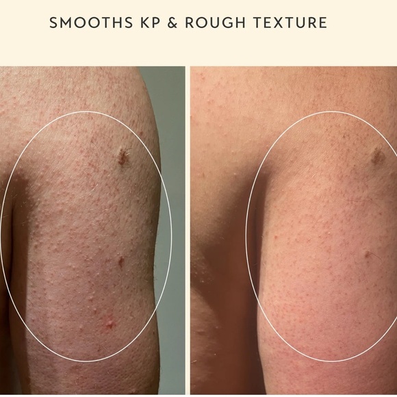 NWT SHANI DARDEN BODY REFORM RETINOL RETINOID TREATMENT SERUM texture firm - Picture 4 of 11